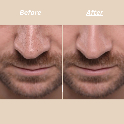 Dr. Melaxin – Peel Shot™